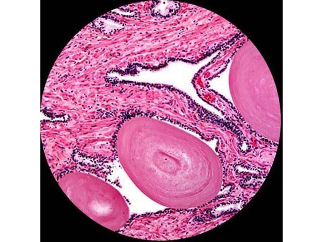 40X-2000X LED Monocular Compound Microscope with Mechanical Stage and Digital Camera J796448